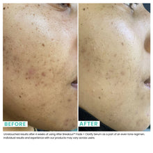 Load image into Gallery viewer, 6% Azelaic Acid Fade + Clarify Serum