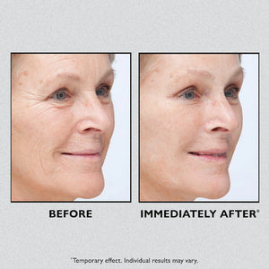 Instant FIRMx® Temporary Face Tightener