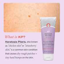 Load image into Gallery viewer, KP Bump Eraser Body Scrub with 10% AHA