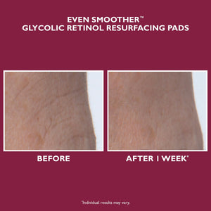 Even Smoother™ Glycolic Retinol Resurfacing Peel Pads