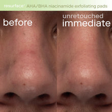 Load image into Gallery viewer, Resurface+ AHA/BHA Niacinamide Exfoliating Pads for Face and Targeted Body