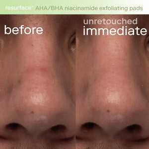 Resurface+ AHA/BHA Niacinamide Exfoliating Pads for Face and Targeted Body