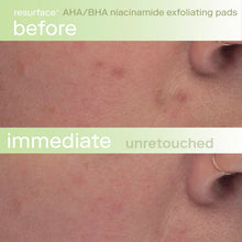 Load image into Gallery viewer, Resurface+ AHA/BHA Niacinamide Exfoliating Pads for Face and Targeted Body