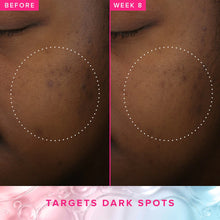 Load image into Gallery viewer, Brighten Up 3% TXA Dark Spot Toner with Azelaic Acid