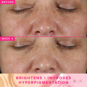 Brighten Up 3% TXA Dark Spot Toner with Azelaic Acid