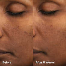 Load image into Gallery viewer, Skin Perfecting 6% Mandelic Acid + 2% Lactic Acid Liquid Exfoliant