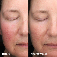 Load image into Gallery viewer, Skin Perfecting 6% Mandelic Acid + 2% Lactic Acid Liquid Exfoliant